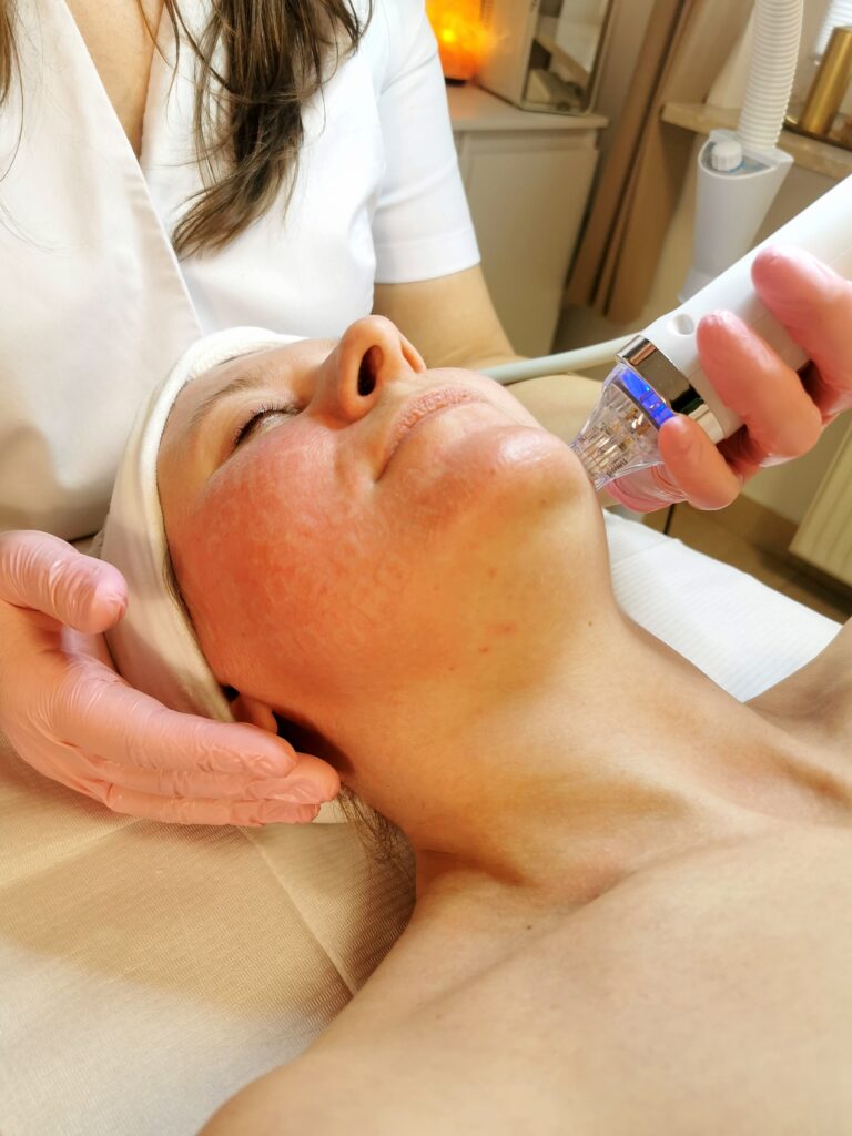 Thermolifting
