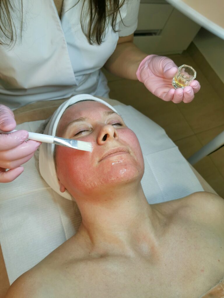Zaawansowane Peelingi i Kwasy
